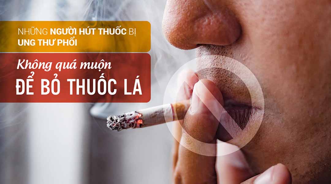 Tác hại thuốc lá đối với sức khỏe của bạn|https://kiemsoatbenhtatbacgiang.vn/zh_CN/chi-tiet-tin-tuc/-/asset_publisher/M0UUAFstbTMq/content/tac-hai-thuoc-la-oi-voi-suc-khoe-cua-b-2