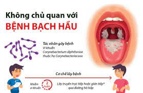 Bộ Y tế chỉ đạo các địa phương khẩn trương tăng cường phát hiện sớm các ca bệnh Bạch hầu|https://kiemsoatbenhtatbacgiang.vn/ja_JP/chi-tiet-tin-tuc/-/asset_publisher/M0UUAFstbTMq/content/bo-y-te-chi-ao-cac-ia-phuong-khan-truong-tang-cuong-phat-hien-som-cac-ca-benh-bach-hau