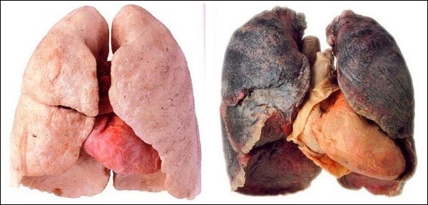 Ảnh hưởng của thuốc lá đến phổi