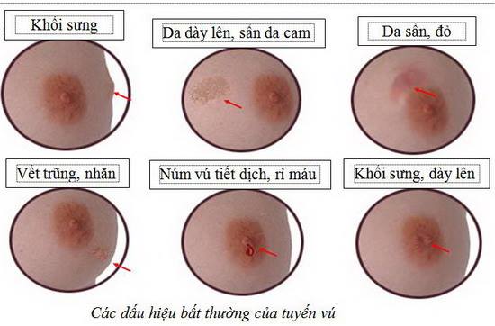 7. Khi Nào Nên Gặp Bác Sĩ?